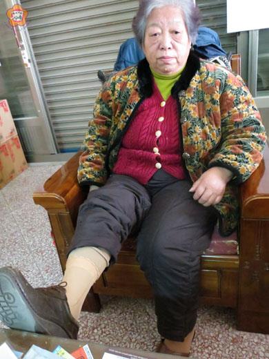 因為誤觸地雷,七十一歲的陳張麗玉在十七歲時失去了右腳小腿。(張建騰攝)