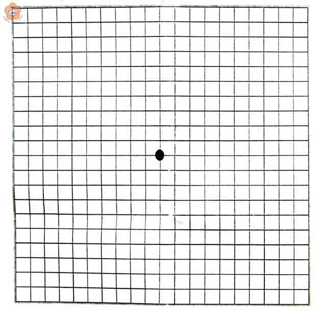 阿姆斯勒方格表共有四百個方格，中間有一個黑點，可用於自我測試老年性黃斑部病變。（張建騰翻攝）